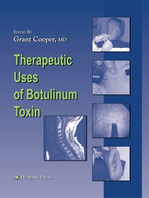 cover image of Therapeutic Uses of Botulinum Toxin